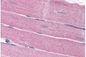 Human Skeletal Muscle (formalin-fixed, paraffin-embedded) stained with SORBS1 antibody ABIN297694 at 2. (SORBS1 anticorps  (AA 1282-1294))