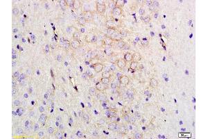 Formalin-fixed and paraffin embedded rat brain labeled with Anti-MMC3 Receptor/MC3-R Polyclonal Antibody, Unconjugated (ABIN872967) at 1:200 followed by conjugation to the secondary antibody and DAB staining. (MC3R anticorps  (AA 131-230))