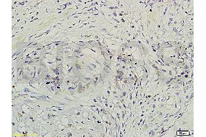 Formalin-fixed and paraffin-embedded rat brain labeled with Rabbit Anti-GRB2/ASH Polyclonal Antibody (ABIN686932) , Unconjugated 1:200 followed by conjugation to the secondary antibody and DAB staining