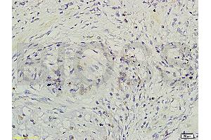 Formalin-fixed and paraffin-embedded rat brain labeled with Rabbit Anti-GRB2/ASH Polyclonal Antibody (ABIN686932) , Unconjugated 1:200 followed by conjugation to the secondary antibody and DAB staining (GRB2 anticorps)