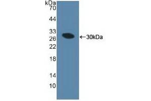 Detection of Recombinant MIB1, Human using Polyclonal Antibody to Mindbomb Homolog 1 (MIB1) (MIB1 anticorps  (AA 769-1000))