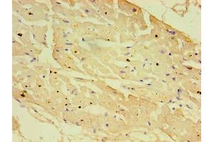 Immunohistochemistry of paraffin-embedded human heart tissue using ABIN7161936 at dilution of 1:100 (NXF3 anticorps  (AA 1-531))