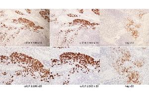 Staining of canine lymph node tissue with bs-3077r. (CSF1R anticorps  (pTyr723))