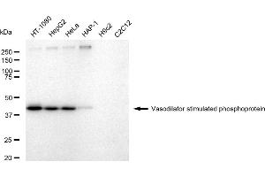 Western blotting analysis using Vasodilator stimulated phosphoprotein antibody (ABIN7800824). (Recombinant VASP anticorps)