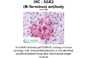 Image no. 1 for anti-serum/glucocorticoid Regulated Kinase Family, Member 3 (SGK3) (N-Term) antibody (ABIN1739228) (SGK3 anticorps  (N-Term))