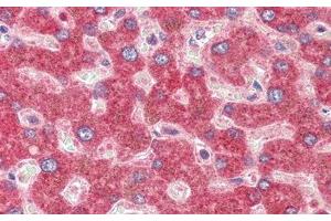 Detection of GLS2 in Human Liver Tissue using Polyclonal Antibody to Glutaminase 2 (GLS2)