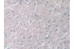 IHC-P analysis of Human Liver Tissue, with DAB staining. (MAPK12 anticorps  (AA 27-311))