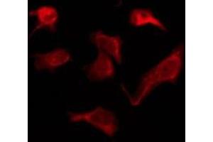 ABIN6276182 staining Hela by IF/ICC.