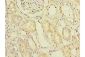 Immunohistochemistry of paraffin-embedded human kidney tissue using ABIN7163092 at dilution of 1:100 (PDCL2 anticorps  (AA 1-241))