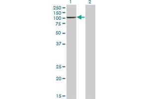 Western Blot analysis of PCAF expression in transfected 293T cell line by PCAF monoclonal antibody (M02), clone 1H2.