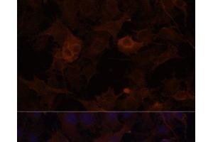 Immunofluorescence analysis of HUVEC cells using FLNB Polyclonal Antibody at dilution of 1:100 (40x lens).