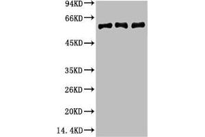 Western blot analysis of 1) Hela, 2) Mouse Brain Tissue, 3) Rat Brain tissue, diluted at 1:2000.