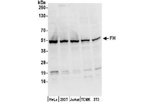 Western Blotting (WB) image for anti-Fumarate Hydratase (FH) (AA 150-200) antibody (ABIN7450248)
