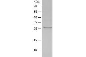 Western Blotting (WB) image for Phosphatidylinositol Transfer Protein, alpha (PITPNA) (AA 1-270) protein (His tag) (ABIN7124403) (PITPNA Protein (AA 1-270) (His tag))
