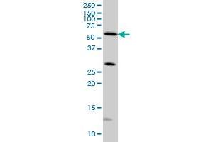 STK4 monoclonal antibody (M02), clone 4F4 Western Blot analysis of STK4 expression in HeLa .