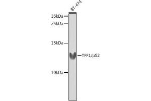 Western blot analysis of extracts of BT-474 cells, using TFF1/pS2 antibody (ABIN3015565, ABIN3015566, ABIN3015567 and ABIN6218896) at 1:1000 dilution.