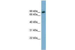 WB Suggested Anti-APBB1IP  Antibody Titration: 0.