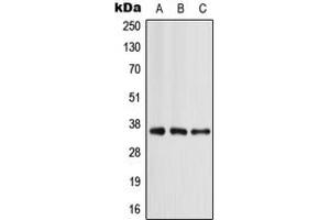 Western blot analysis of Apolipoprotein E expression in MCF7 (A), mouse liver (B), rat liver (C) whole cell lysates. (APOE anticorps  (Center))