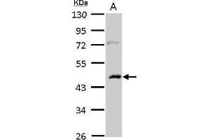 WB Image Casein Kinase 1 alpha 1L antibody detects CSNK1A1L protein by Western blot analysis. (CSNK1A1L anticorps)