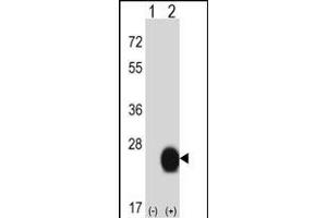Western blot analysis of CSRP2 (arrow) using rabbit polyclonal CSRP2 Antibody (Center) (ABIN657989 and ABIN2846936). (CSRP2 anticorps  (AA 68-96))