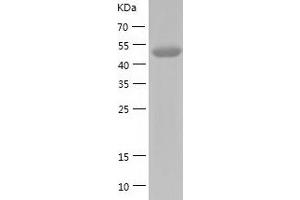 Western Blotting (WB) image for Homogentisate 1,2-Dioxygenase (HGD) (AA 1-445) protein (His tag) (ABIN7123359) (HGD Protein (AA 1-445) (His tag))