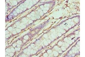 Immunohistochemistry of paraffin-embedded human colon tissue using ABIN7171965 at dilution of 1:100