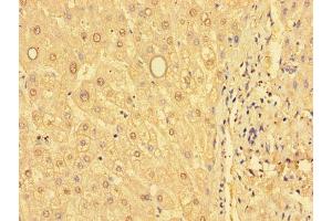 Immunohistochemistry of paraffin-embedded human liver tissue using ABIN7154103 at dilution of 1:100