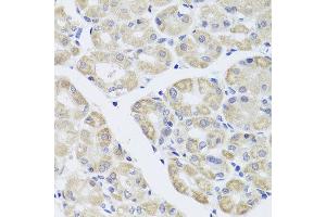 Immunohistochemistry of paraffin-embedded human stomach using DISC1 antibody at dilution of 1:100 (x40 lens). (DISC1 anticorps)