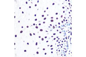 Immunohistochemistry of paraffin-embedded human esophageal using NELFE Rabbit pAb (ABIN6127278, ABIN6144526, ABIN6144528 and ABIN6220173) at dilution of 1:100 (40x lens).