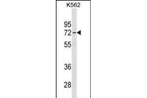 anti-Interleukin 22 Receptor, alpha 1 (IL22RA1) (AA 408-436), (C-Term) antibody