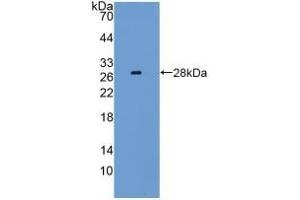 Detection of Recombinant LAG3, Mouse using Polyclonal Antibody to Lymphocyte Activation Gene 3 (LAG3) (LAG3 anticorps  (AA 274-504))