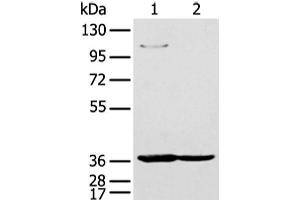 Western blot analysis of 293T and K562 cell using NUDT19 Polyclonal Antibody at dilution of 1:350 (NUDT19 anticorps)