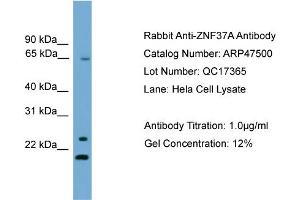 WB Suggested Anti-ZNF37A  Antibody Titration: 0. (ZNF37A anticorps  (Middle Region))