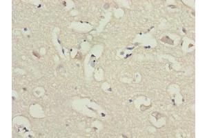 Immunohistochemistry of paraffin-embedded human brain tissue using ABIN7143514 at dilution of 1:100 (ARL6IP1 anticorps  (AA 93-133))