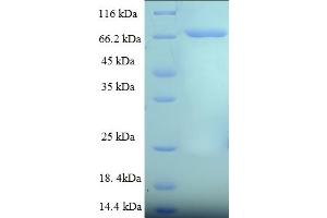 SDS-PAGE (SDS) image for Cytoplasmic Polyadenylation Element Binding Protein 1 (CPEB1) (AA 1-486), (full length) protein (His-SUMO Tag) (ABIN5711755)