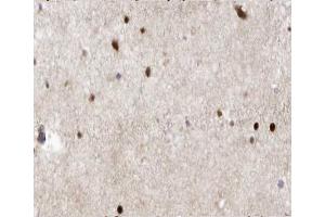 ABIN6266543 at 1/100 staining human brain tissue sections by IHC-P.