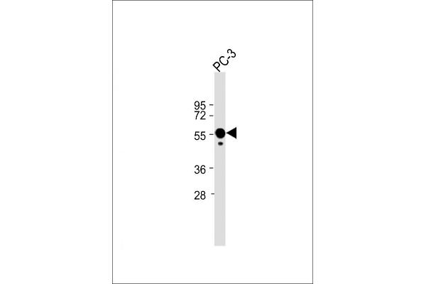 Calreticulin anticorps  (AA 277-305)