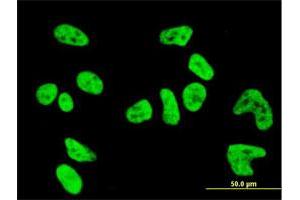 Immunofluorescence of monoclonal antibody to PKN1 on HeLa cell.