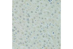 Immunohistochemistry of paraffin-embedded mouse liver using RCC1 antibody (ABIN5973761) at dilution of 1/100 (40x lens). (RCC1 anticorps)