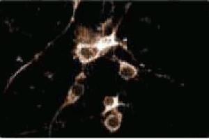 Immunofluorescence staining of rat cortical neurons.