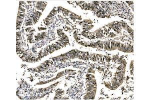 IHC analysis of EHMT2/G9A using anti-EHMT2/G9A antibody (ABIN7602084). (EHMT2 anticorps  (AA 580-1195))