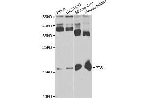 Western blot analysis of extracts of various cell lines, using PTS antibody. (PTS anticorps)