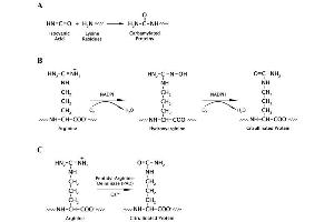 Mechanisms of (A) Homocitrullination (Carbamylation) of Proteins by Isocyanic Acid. (Homocitrulline/Citrulline Assay Kit)