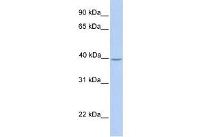 WB Suggested Anti-SAMSN1 Antibody Titration:  0.