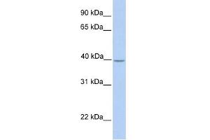 WB Suggested Anti-SAMSN1 Antibody Titration:  0. (SAMSN1 anticorps  (Middle Region))