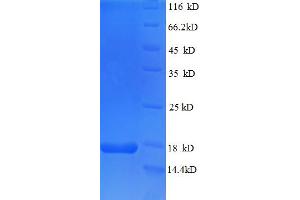 SDS-PAGE (SDS) image for Teratocarcinoma-Derived Growth Factor 1 (TDGF1) (AA 32-150), (partial) protein (His tag) (ABIN5712756)
