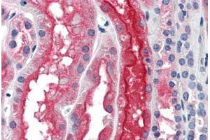 Human Kidney: Formalin-Fixed, Paraffin-Embedded (FFPE)