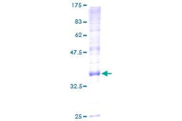 ATP5G2 Protein (AA 1-141) (GST tag)
