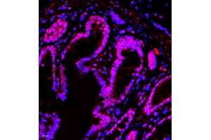 Immunofluorescence of paraffin embedded rat colon using TFIIIC110 (ABIN7074038) at dilution of 1:650 (400x lens)