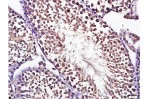 Paraformaldehyde-fixed, paraffin embedded mouse testis, Antigen retrieval by boiling in sodium citrate buffer (pH6.